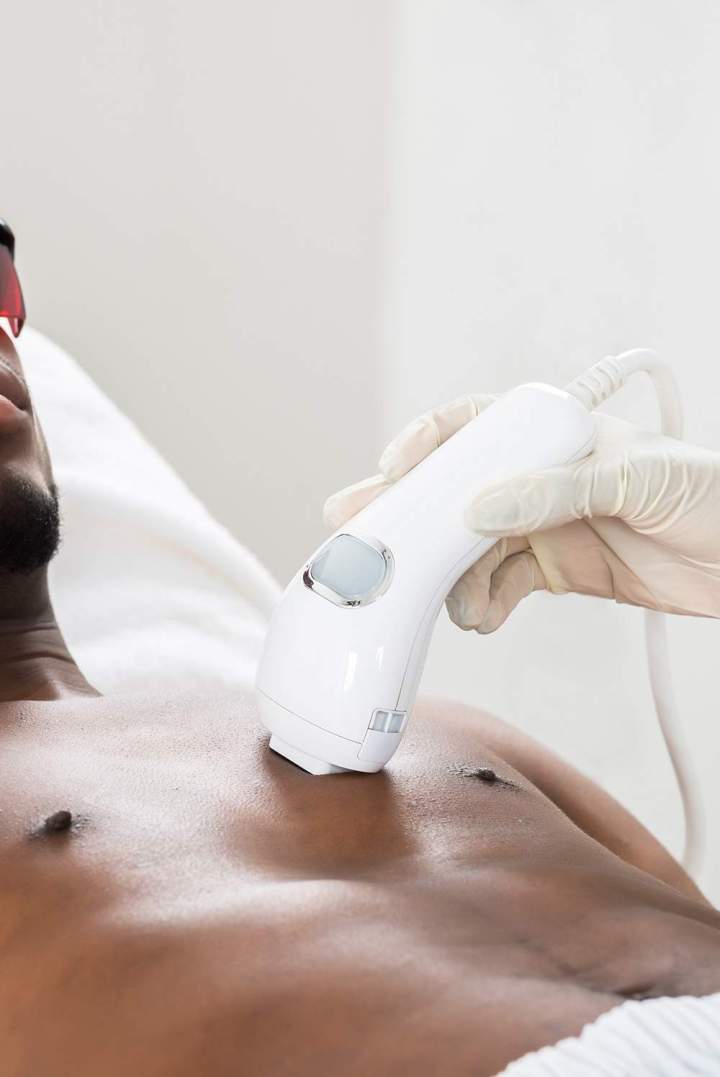 Épilation définitive au laser Martinique